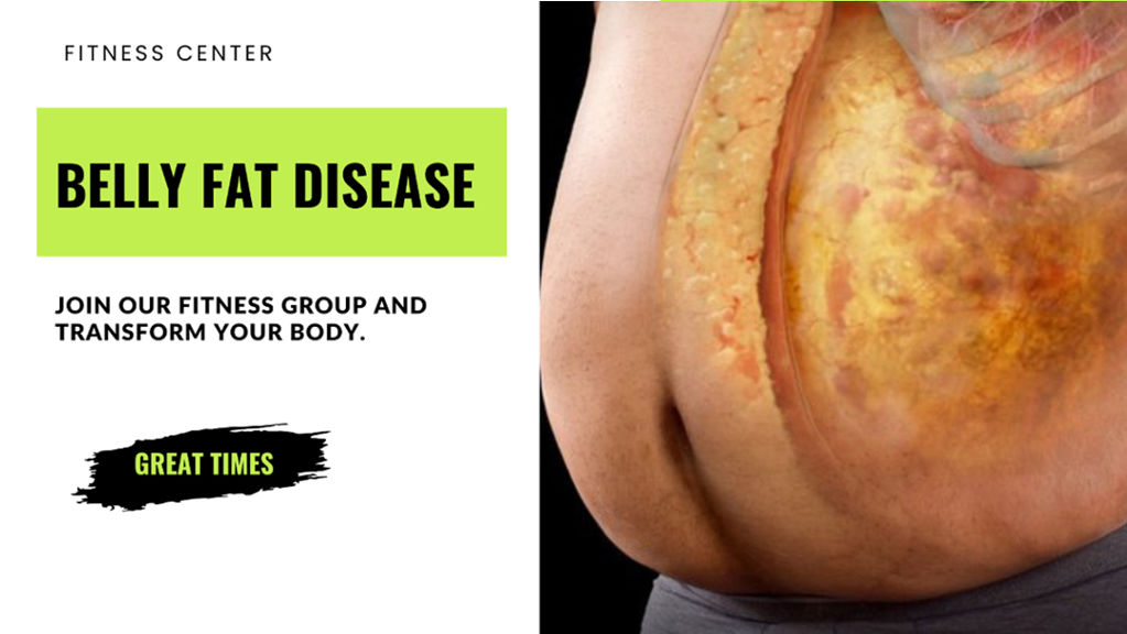 Belly Fat Disease